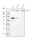 Neurofibromin 1 antibody, M00043-1, Boster Biological Technology, Western Blot image 