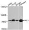 HIC ZBTB Transcriptional Repressor 1 antibody, A9651, ABclonal Technology, Western Blot image 