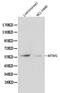 Myotubularin 1 antibody, PA5-37126, Invitrogen Antibodies, Western Blot image 