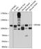 EPH Receptor A8 antibody, 13-505, ProSci, Western Blot image 