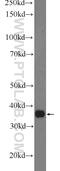 Acid Phosphatase 4 antibody, 24326-1-AP, Proteintech Group, Western Blot image 