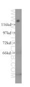 Splicing Factor 3b Subunit 2 antibody, 10919-1-AP, Proteintech Group, Western Blot image 