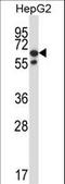 Protein Phosphatase, Mg2+/Mn2+ Dependent 1G antibody, LS-C162072, Lifespan Biosciences, Western Blot image 