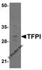 Lipoprotein-associated coagulation inhibitor antibody, 7441, ProSci Inc, Western Blot image 