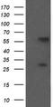 Chaperonin Containing TCP1 Subunit 8 Like 2 antibody, CF505302, Origene, Western Blot image 