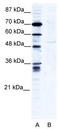 Zinc Finger Protein 134 antibody, TA339077, Origene, Western Blot image 