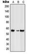 Glycine Receptor Beta antibody, MBS821805, MyBioSource, Western Blot image 