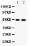 Alkaline Phosphatase, Biomineralization Associated antibody, PA1004-1, Boster Biological Technology, Western Blot image 