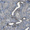 Stromal interaction molecule 1 antibody, HPA011088, Atlas Antibodies, Immunohistochemistry paraffin image 