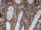 Apurinic/Apyrimidinic Endodeoxyribonuclease 1 antibody, M00627-1, Boster Biological Technology, Immunohistochemistry paraffin image 