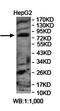 Leucine Rich Repeats And Calponin Homology Domain Containing 2 antibody, orb78430, Biorbyt, Western Blot image 