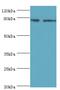 SET And MYND Domain Containing 4 antibody, MBS1498043, MyBioSource, Western Blot image 
