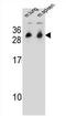 Cytochrome B561 Family Member D1 antibody, AP51154PU-N, Origene, Western Blot image 