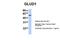 Glutamate dehydrogenase 1, mitochondrial antibody, NBP1-54962, Novus Biologicals, Western Blot image 