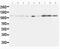 EPH Receptor A1 antibody, PA5-79210, Invitrogen Antibodies, Western Blot image 