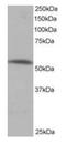 Protein Phosphatase 2 Regulatory Subunit B'Alpha antibody, orb18661, Biorbyt, Western Blot image 