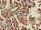 Transmembrane Protein 173 antibody, LS-C679827, Lifespan Biosciences, Immunohistochemistry paraffin image 