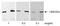 Eukaryotic Translation Initiation Factor 4 Gamma 1 antibody, GTX22609, GeneTex, Western Blot image 