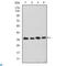 Cyclin Dependent Kinase 5 antibody, LS-C812543, Lifespan Biosciences, Western Blot image 