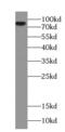 SH3 Domain Containing Kinase Binding Protein 1 antibody, FNab01712, FineTest, Western Blot image 