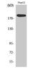 DNA Polymerase Alpha 1, Catalytic Subunit antibody, A04421, Boster Biological Technology, Western Blot image 