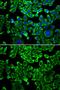 Eukaryotic Translation Initiation Factor 4B antibody, GTX33175, GeneTex, Immunocytochemistry image 