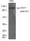 Signal Transducer And Activator Of Transcription 1 antibody, GTX50217, GeneTex, Western Blot image 