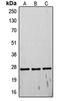 TIMP Metallopeptidase Inhibitor 4 antibody, orb214674, Biorbyt, Western Blot image 