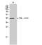 Transducer Of ERBB2, 1 antibody, STJ90995, St John