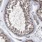 Proteasome 26S Subunit, Non-ATPase 13 antibody, NBP1-80961, Novus Biologicals, Immunohistochemistry paraffin image 