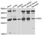 Cyclin Dependent Kinase 2 antibody, A0294, ABclonal Technology, Western Blot image 