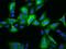 Ribonucleotide Reductase Regulatory Subunit M2 antibody, GTX02222, GeneTex, Immunocytochemistry image 