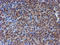 Ribosomal Protein S6 Kinase B1 antibody, LS-C337368, Lifespan Biosciences, Immunohistochemistry paraffin image 