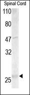 MPP antibody, 250762, Abbiotec, Immunohistochemistry paraffin image 