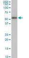 Tubulin Beta 2A Class IIa antibody, H00007280-M02, Novus Biologicals, Western Blot image 