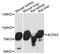 Acyl-CoA Synthetase Short Chain Family Member 3 antibody, A14541, Boster Biological Technology, Western Blot image 