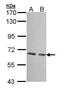 Glucokinase Regulator antibody, PA5-27959, Invitrogen Antibodies, Western Blot image 