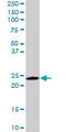 RAB6A, Member RAS Oncogene Family antibody, LS-C133076, Lifespan Biosciences, Western Blot image 