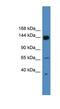 UPF2 Regulator Of Nonsense Mediated MRNA Decay antibody, NBP1-80460, Novus Biologicals, Western Blot image 