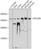 Myosin-XVIIIa antibody, A02344, Boster Biological Technology, Western Blot image 