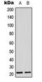 PAMP antibody, LS-C353883, Lifespan Biosciences, Western Blot image 