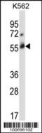 Cbl Proto-Oncogene C antibody, 56-524, ProSci, Western Blot image 