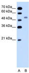 Solute Carrier Family 12 Member 1 antibody, TA346032, Origene, Western Blot image 