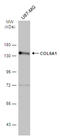 Collagen Type VI Alpha 1 Chain antibody, GTX109963, GeneTex, Western Blot image 