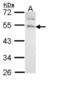 Gastrin Releasing Peptide Receptor antibody, NBP2-16751, Novus Biologicals, Western Blot image 