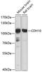 Cadherin 10 antibody, 13-498, ProSci, Western Blot image 