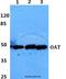 Ornithine Aminotransferase antibody, A01126, Boster Biological Technology, Western Blot image 