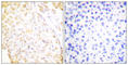 NK3 Homeobox 1 antibody, abx013154, Abbexa, Western Blot image 