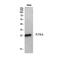 Fms Related Tyrosine Kinase 3 Ligand antibody, GTX34380, GeneTex, Western Blot image 