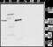 Transient Receptor Potential Cation Channel Subfamily M Member 3 antibody, GTX16612, GeneTex, Western Blot image 